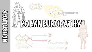 Approach to Polyneuropathy  causes pathophysiology investigations [upl. by Nonregla]