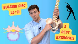 Bulging Disc L5S1 The 5 Best Exercises Explained in Detail [upl. by Ener]