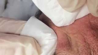 How To Remove a Whitehead Soft Sebum [upl. by Electra]