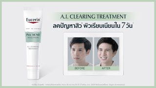 ผู้ชายเป็นสิวเยอะ จัดการด้วย Eucerin Pro ACNE SOLUTION AI CLEARING TREATMENT [upl. by Eldnek]