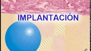 implantacion [upl. by Hploda]