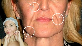 Face lift massage for sagging jowls nasolabial folds sagging cheeks double chin and wrinkles [upl. by Franciskus]