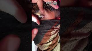 Anisocoria EYE 👁️ Medical points 🤔 आप भी चेक कर लो armymedical viralvideo [upl. by Cooley]