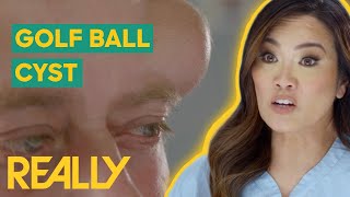 Dr Lee Removes 16YearOld GOLF BALLSized Cyst  Dr Pimple Popper [upl. by Jedlicka]