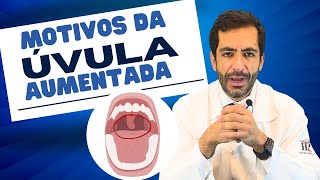 Úvula sininho campainha da garganta está inchada o que pode ser [upl. by Candace]