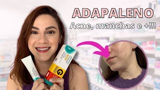 ADAPALENO ACABA COM A ACNE CLAREIA MANCHAS E MUITO MAIS [upl. by Tad905]