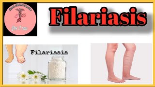 Filariasis l Causes l Sign amp Symptoms l Management [upl. by Teplitz78]