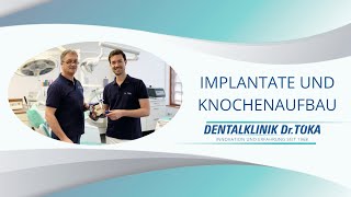 Implantate und Knochenaufbau Erklärvideo Dentalklinik Dr Tóka in SopronUngarn [upl. by Branca982]