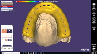 Occlusal Night Guard Design and Print Using Exocad and Formlabs 2 [upl. by Nahraf]