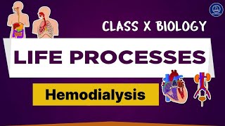 Hemodialysis l Artificial kidney l Life Processes Class 10th biology [upl. by Manlove]