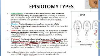 Obstetrics 669 d Episiotomy Types Different Compare Difference Median MedioLateral J Shaped [upl. by Gnoix]