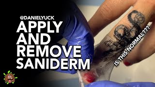 Applying And Removing Saniderm Is This Normal [upl. by Columbus]