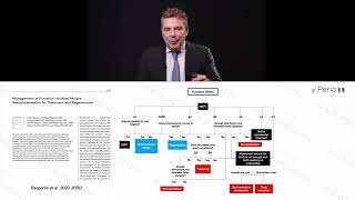 Management of furcation involvement [upl. by Wildee]