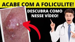 O MELHOR PRODUTO CONTRA FOLICULITE E PELOS ENCRAVADOS DESCUBRA QUAL É NESSE VÍDEO [upl. by Juni]