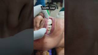 Instant smile in 30 minutes  Dr G Konda Reddy Dental hospital in Nellore viralvideo shorts [upl. by Goldia]