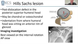 Your patient may have dislocated their shoulder what might you do [upl. by Karen]