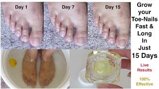 Grow your ToeNails fast and long in just 15 days  Faster Nail Growth  Mamtha Nair [upl. by Selrahc]