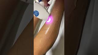 Dauerhafte HaarentfernungMit Liebe zum Detail ⚡️ skincare shortsvideo laserhairremoval [upl. by Ahsina936]