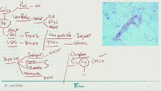 Sindrome nefrotico [upl. by Reggie]