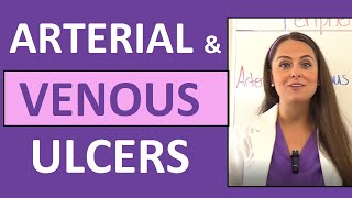 Arterial Ulcers vs Venous Ulcers Nursing Characteristics for PVD Peripheral Vascular Disease [upl. by Nooj855]