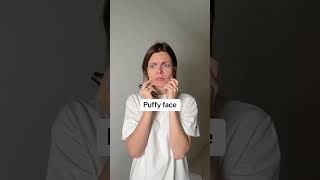 Can’t get rid of acne and face puffiness [upl. by Berry]