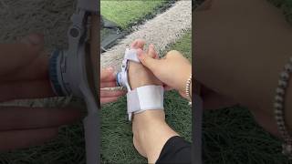 Part 146 bigfootboneprotrusion thumbvalgus separate toesviralvideoytshorts [upl. by Levine206]