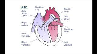 Paediatrics  cardiology [upl. by Werdma]