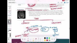 cerebral edema neurology 70  First Aid USMLE Step 1 in UrduHindi [upl. by Ylrbmik267]