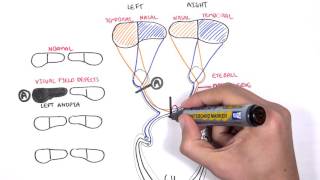 Visual Pathway and Lesions [upl. by Dorelia]