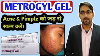 Metrogyl Gel for Acne के बारे में पूरी जानकारी। Metrogyl gel Review  Metrogyl gel Uses in Hindi [upl. by Froemming366]