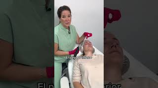 Tratamiento blefaroplastia sin cirugia [upl. by Aniger]