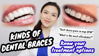 KINDS OF DENTAL BRACES 🦷  WHATS BEST FOR YOU 🤔  Pinoy Dentist  Dr Bianca Beley [upl. by Kcorb]