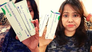 My 1 Month Experience  Salicylic Acid Ointment IP 6  SALICYLIX SF6 [upl. by Nomi]