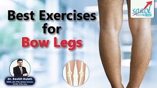 Top Exercises for Bow Legs  Treatment for varus deformity  D Rachit Gulati  SAAOL Ortho Care [upl. by Euell484]