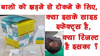 Mintop Yuva Solution 5 Minoxidil  DrReddys Mintop  Minoxidil Work🔥🔥 [upl. by Clara]