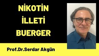 Sigarayı neden bırakmalı Nikotin Allerjisi Burger Hastalığı Damar Tıkanıklığı Serdar Akgün [upl. by Reynolds]