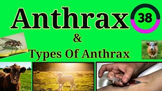 Anthrax EnteMicrobialWorldmicrobiology microbes anthrax infection infectious educational [upl. by Donielle312]