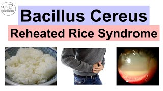 Bacillus Cereus Reheated Rice Syndrome Food Poisoning Pathology Symptoms Diagnosis Treatment [upl. by Monica]