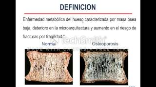 FSPTA 2022 Osteoporosis [upl. by Vidovic]