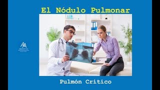 Nódulo Pulmonar no siempre es igual a Cáncer [upl. by Arsi]