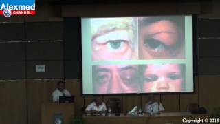 Ophthalmology Final Revision  Part 3 [upl. by Dixil]