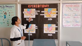 explanation about episiotomy procedure🧑‍⚕️ shortvideo exploremore exploremore episiotomy nurse [upl. by Healy630]