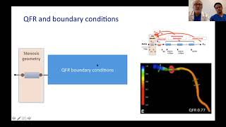 QFR influenced by microcirculatory dysfunction 2018 [upl. by Adekan253]