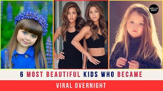 6 Most Beautiful Kids Who Became Viral Overnight [upl. by Hiller]