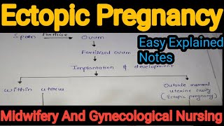 Notes Of Ectopic Pregnancy in Midwifery And Gynecological Nursing in Hindi [upl. by Yevol336]