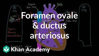 Foramen ovale and ductus arteriosus  Circulatory system physiology  NCLEXRN  Khan Academy [upl. by Ynoyrb]