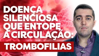 Trombofilia mutação gene MTHFR fator V Leiden SAAF e outras causas de veias entupidas e trombose [upl. by Nnaed490]