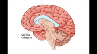 Section of the corpus Callosum and effect on left and right visual field [upl. by Leunammi]