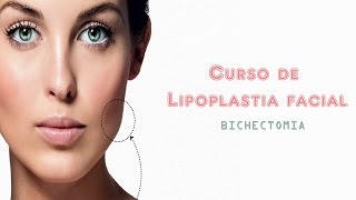 Bichectomia  Lipoplastia facial [upl. by Eronaele]