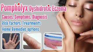 Pompholyx overview causes signs symptoms treatment option and home remedies  Dyshidrotic eczema [upl. by Aihn456]